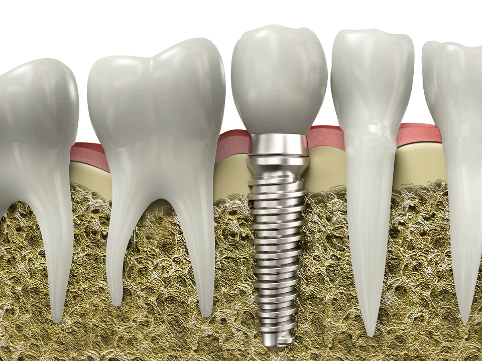 dental service